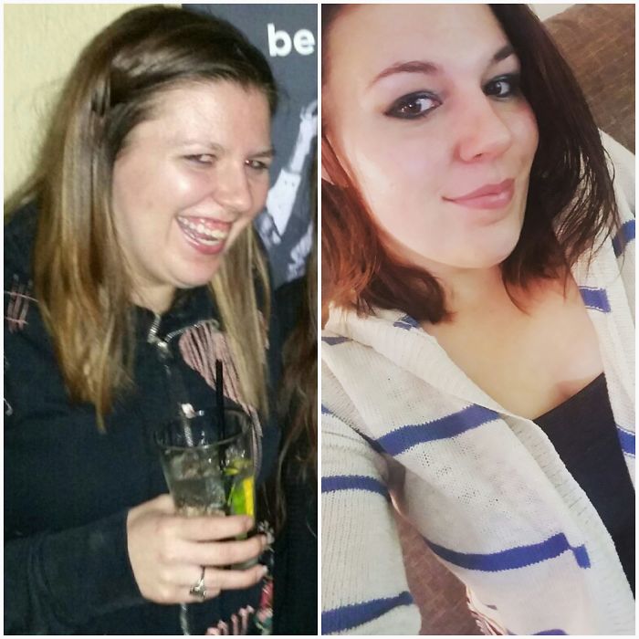 98 Before-And-After Pics Show What Happens When You Stop Drinking