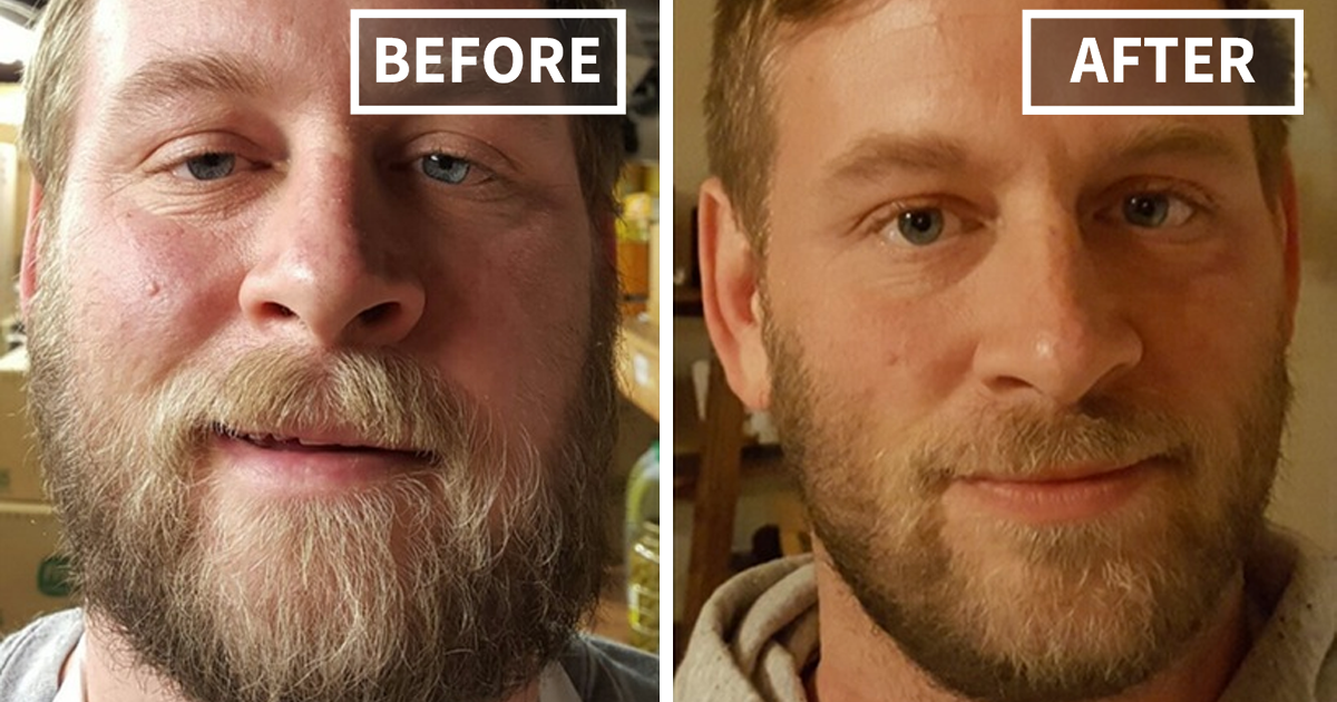 98 before-and-after pics show what happens when you stop drinking
