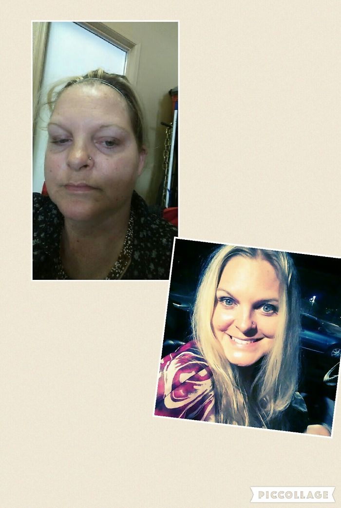 98 Before-And-After Pics Show What Happens When You Stop Drinking