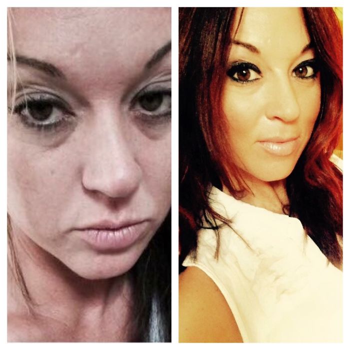98 Before-And-After Pics Show What Happens When You Stop Drinking