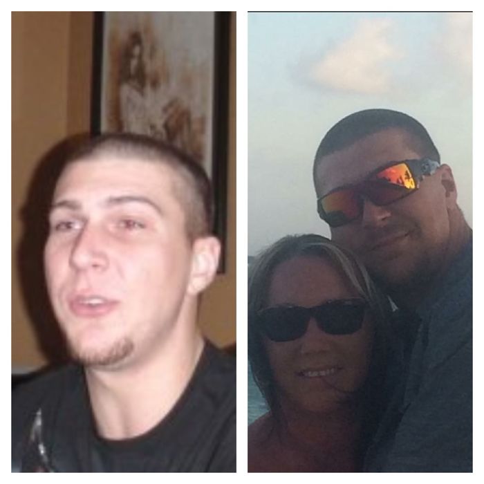 98 Before-And-After Pics Show What Happens When You Stop Drinking