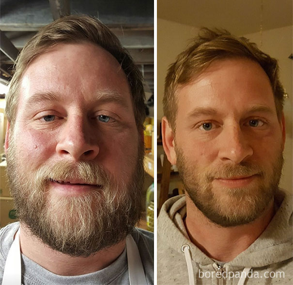 98 Before-And-After Pics Show What Happens When You Stop Drinking