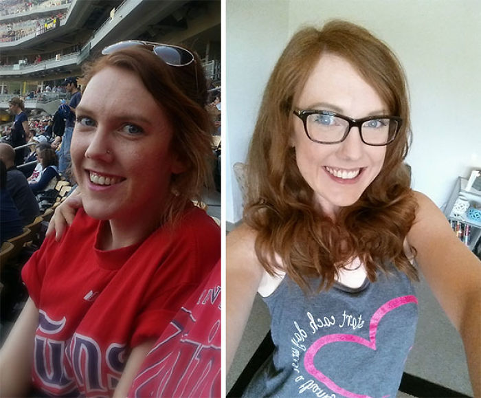 98 Before-And-After Pics Show What Happens When You Stop Drinking