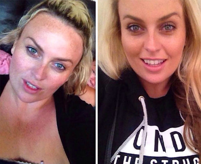 98 Before-And-After Pics Show What Happens When You Stop Drinking