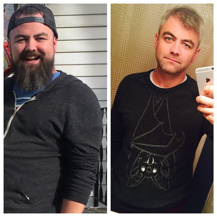 98 Before-And-After Pics Show What Happens When You Stop Drinking