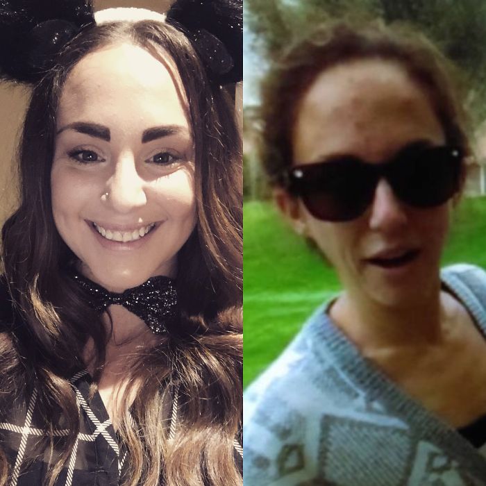 98 Before-And-After Pics Show What Happens When You Stop Drinking