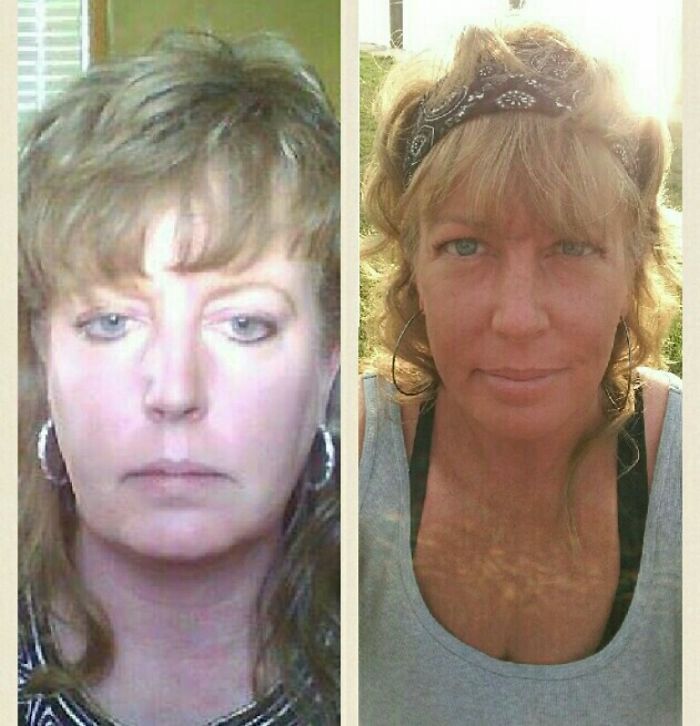98 Before-And-After Pics Show What Happens When You Stop Drinking