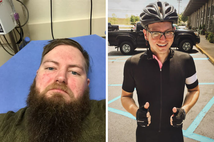 98 Before-And-After Pics Show What Happens When You Stop Drinking
