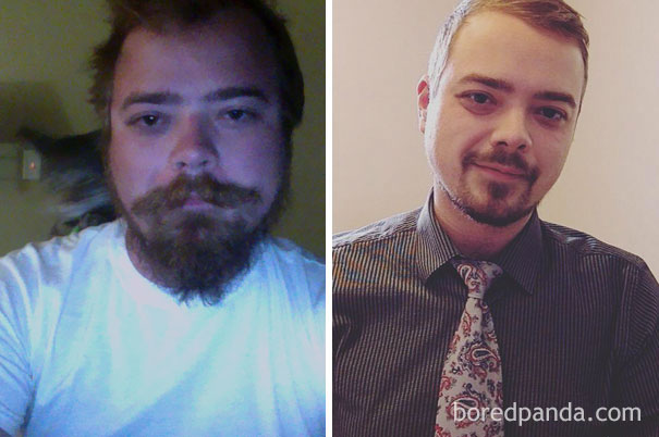 98 Before-And-After Pics Show What Happens When You Stop Drinking