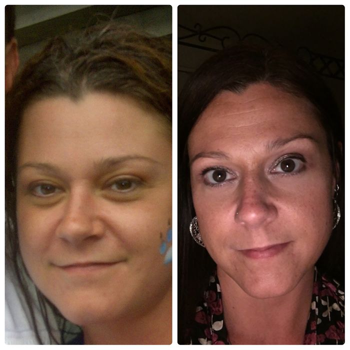 98 Before-And-After Pics Show What Happens When You Stop Drinking