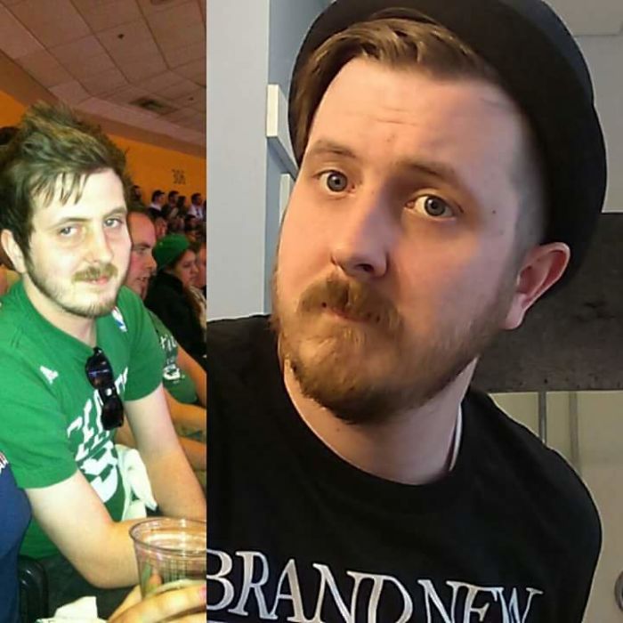 98 Before-And-After Pics Show What Happens When You Stop Drinking