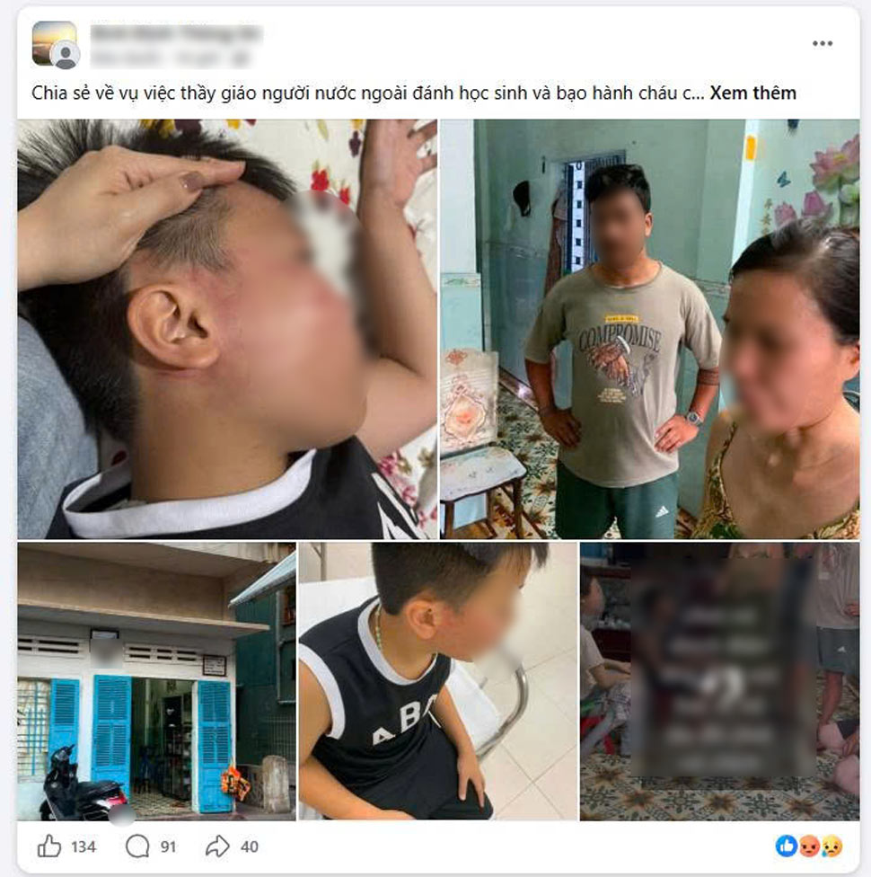 Vụ giáo viên nước ngoài tát học sinh nhập viện, lộ lớp dạy thêm chui