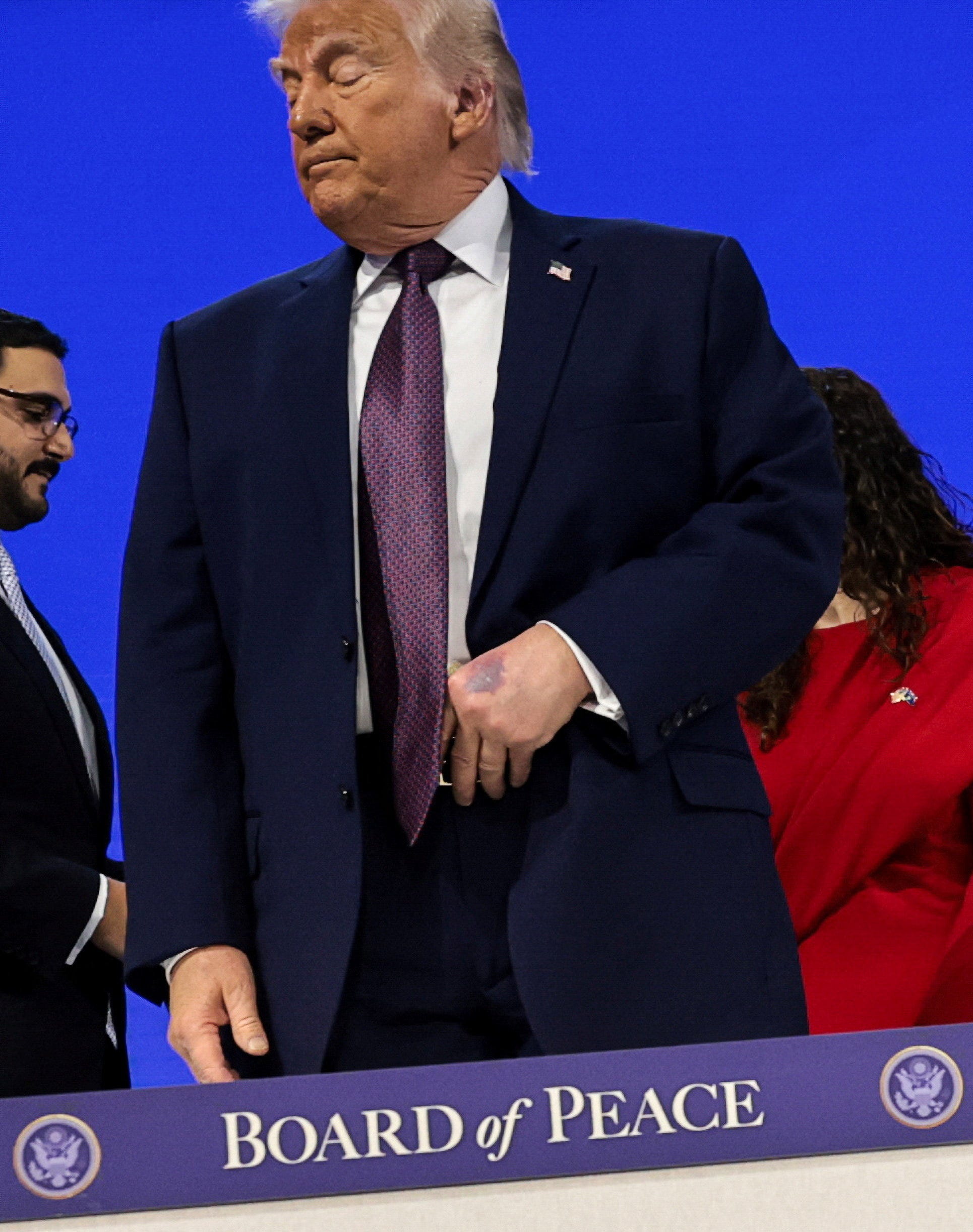 Trump's Annual Physical at Walter Reed Raises Health Questions