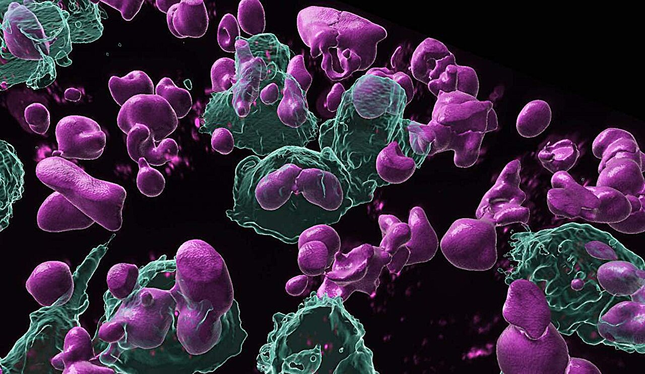 Immune memory cells in ovarian cancer produce tumor-targeting ...