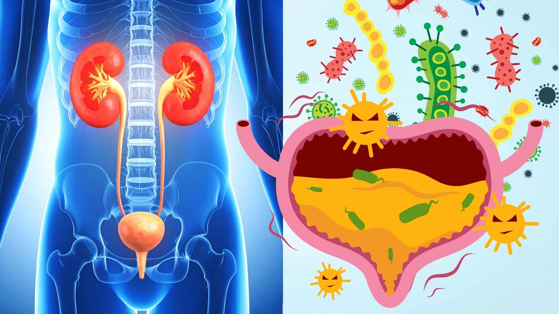 Nhiễm trùng đường tiết niệu tái phát, cơ thể đang cảnh báo điều gì