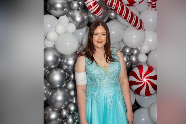 Football match to be held in honour of woman who died from rare form of ...