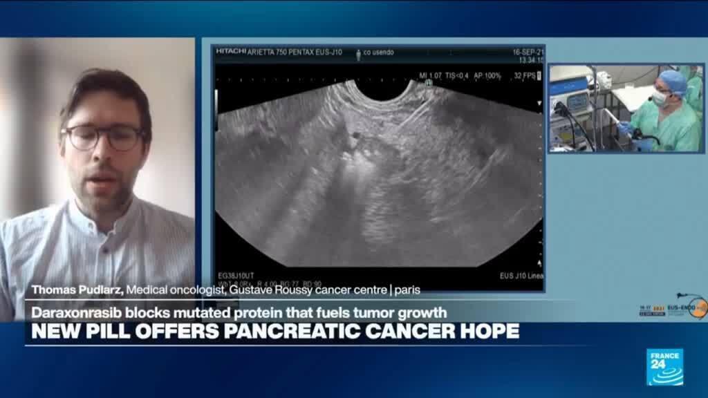 Pancreatic cancer: Dr. Pudlarz praises 'new generation targeted therapy ...