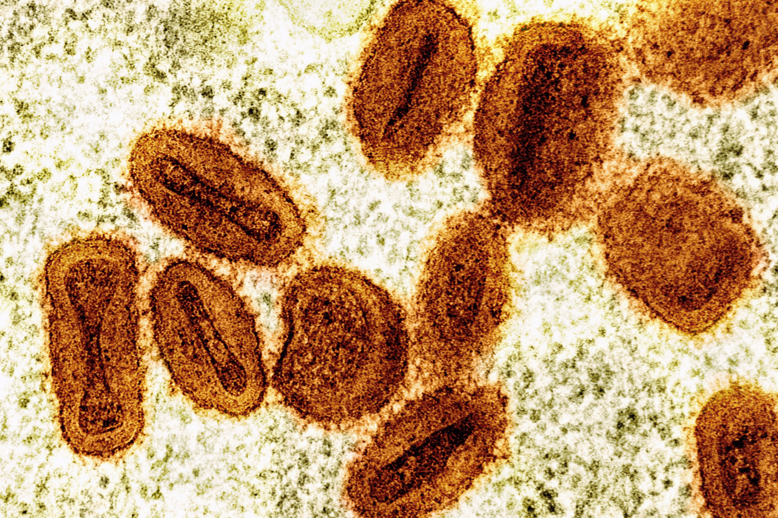 Two researchers charged with smuggling mpox into the US