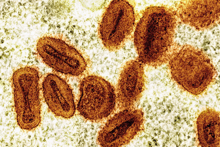 This colorized electron microscope image provided by the National Institute of Allergy and Infectious Diseases in 2024 shows Mpox virus particles, orange, found within infected cells, green. (NIAID via AP, File) (Local Library)