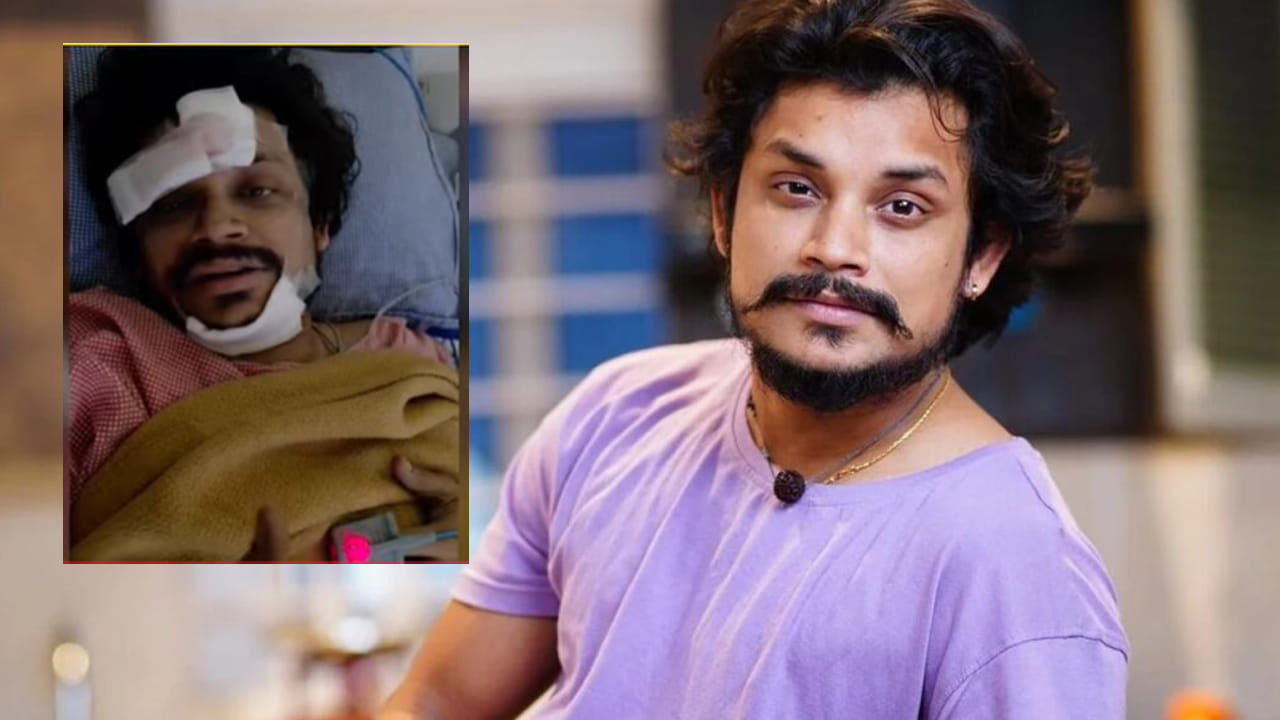 Pandu Master: పండు మాస్టర్ హెల్త్ అప్డేట్.. విరిగిన 2 కాళ్లు ...