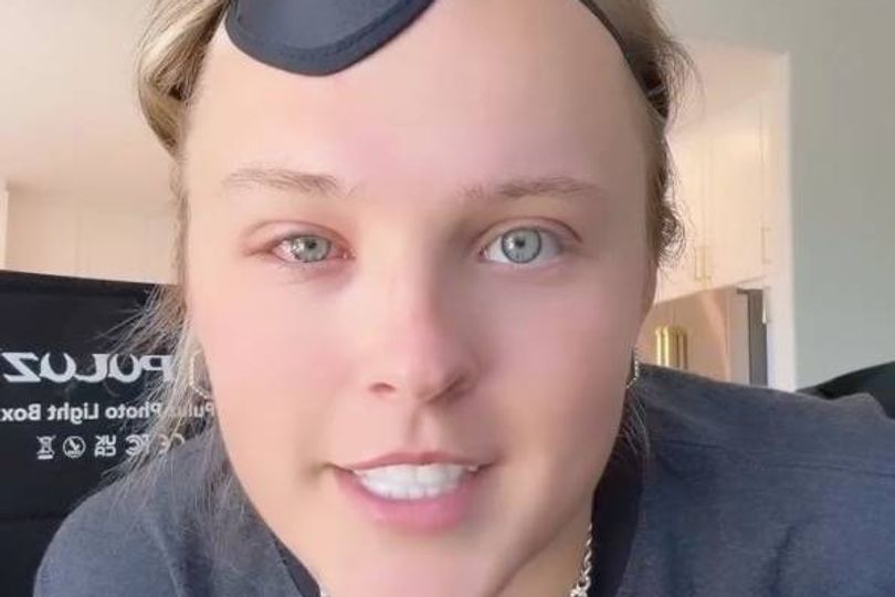 jojo-siwa-says-she-s-very-lucky-after-golf-cart-accident-left-her-injured