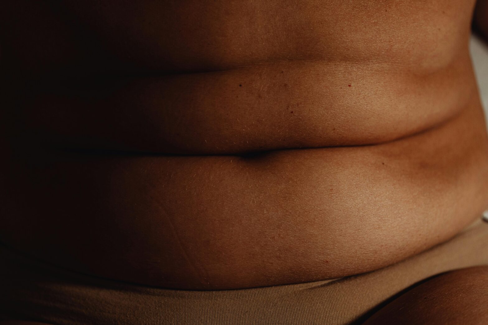 Managing an apron belly: Practical lifestyle tips for a healthier core