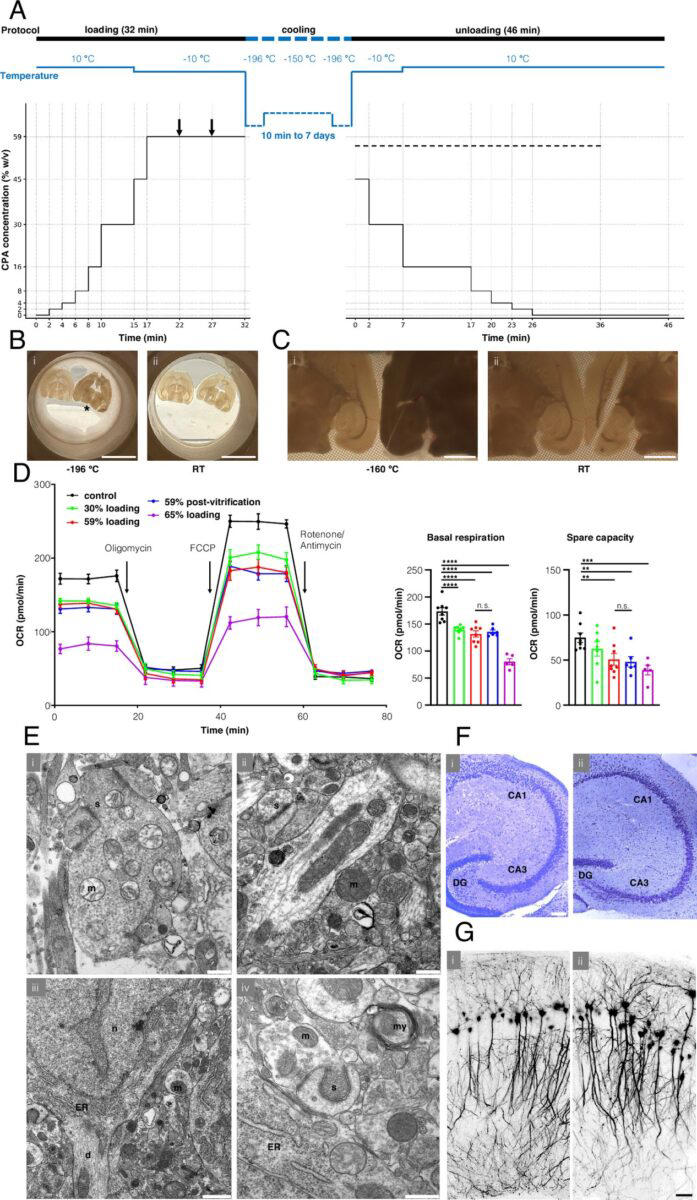Scientists revive mouse brains frozen to -196°C, hinting at possible ...