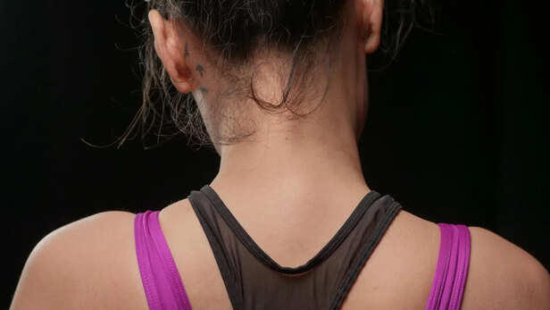 7 natural tricks to get rid of a dark neck fast
