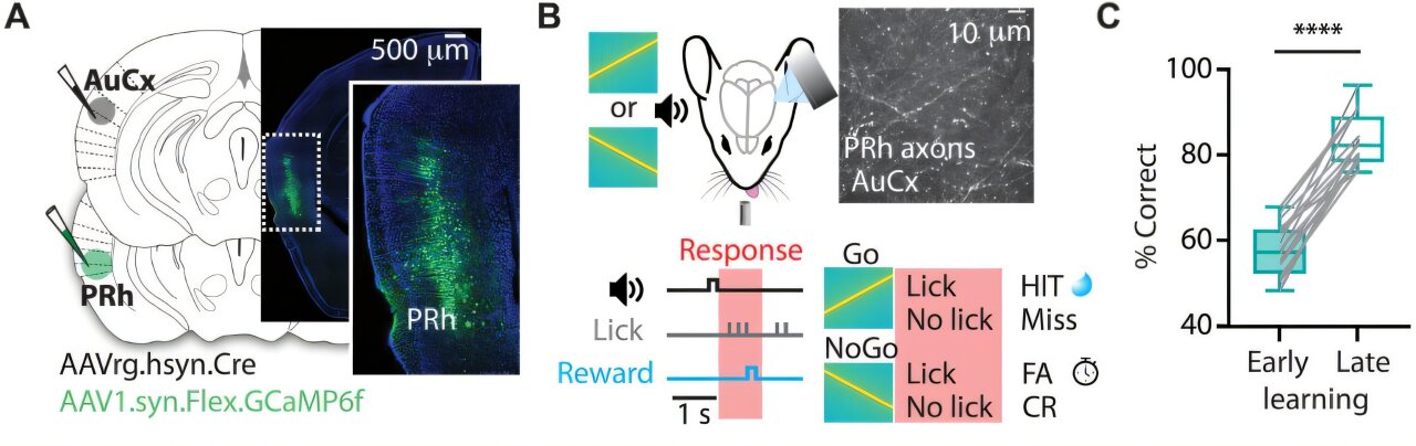 Brain circuit links memory to hearing, revealing how learned sounds ...