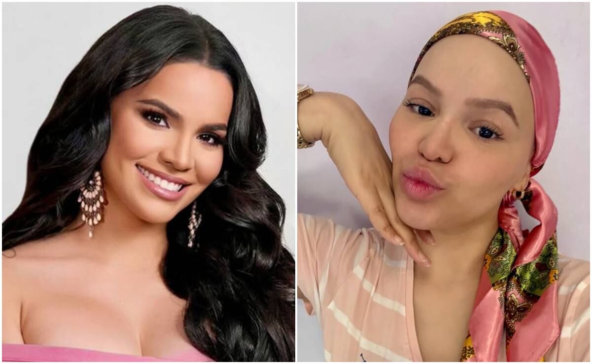 Miss Universe Puerto Rico lucha contra el cáncer de seno a sus 32 años ...