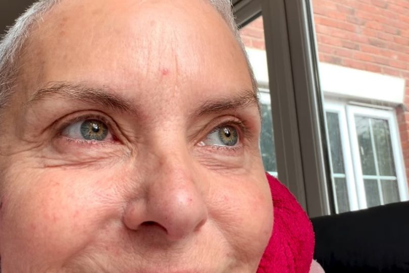 coronation-street-s-tracy-shaw-opens-up-on-chemotherapy-reality-as-body