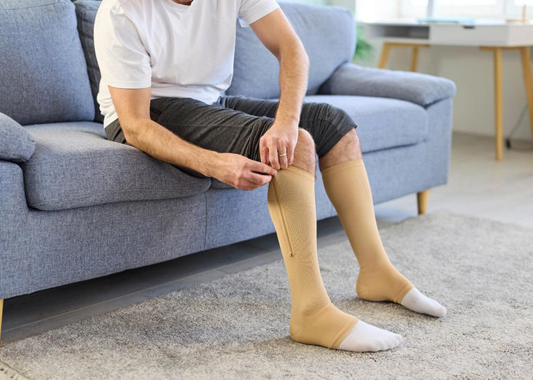 Why leg fatigue and spider veins are getting more attention in everyday ...