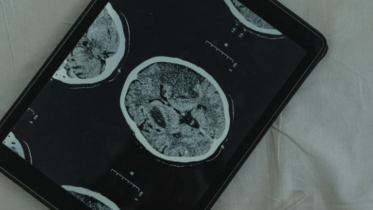 Brain scans showed recalling a fact and reliving a memory light up ...