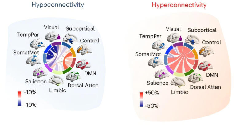 Autism may have two distinct subtypes based on brain connectivity patterns