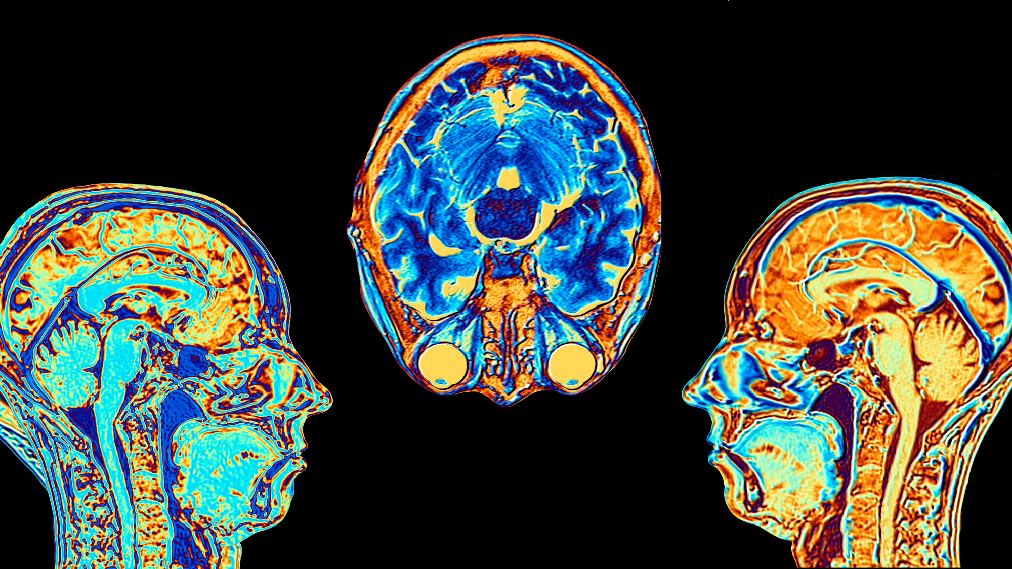 Why this biotech company is keeping bodiless human brains alive in a lab