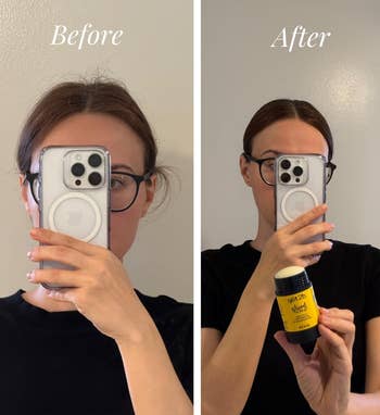 Before and after photos showing hair growth results. In the after photo, a person holds a bottle labeled