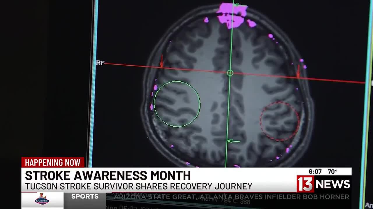 Tucson stroke survivor shares recovery journey during Stroke Awareness ...