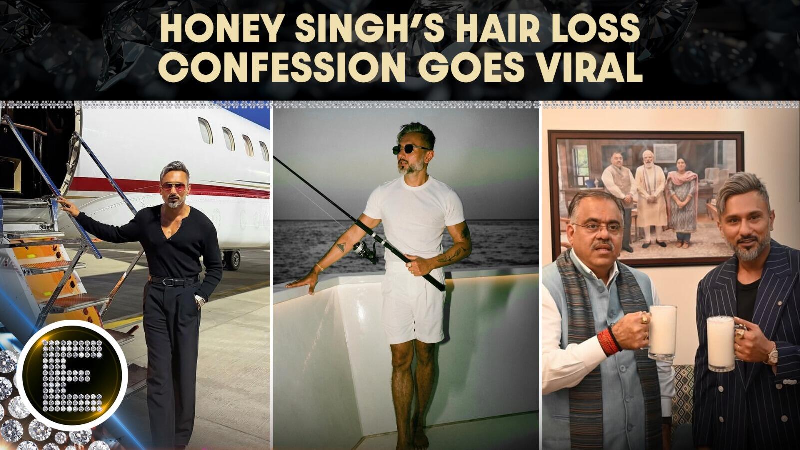 “This is a wig”, Yo Yo Honey Singh’s shocking confession sparks massive