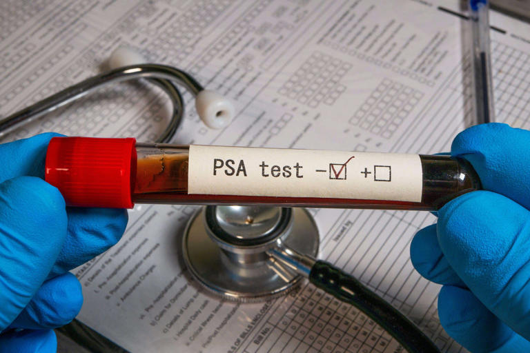 Prostate cancer screening: Final guidance recommends against testing ...
