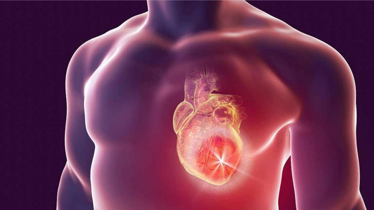 Cómo detectar el riesgo de un infarto antes de que sea demasiado tarde
