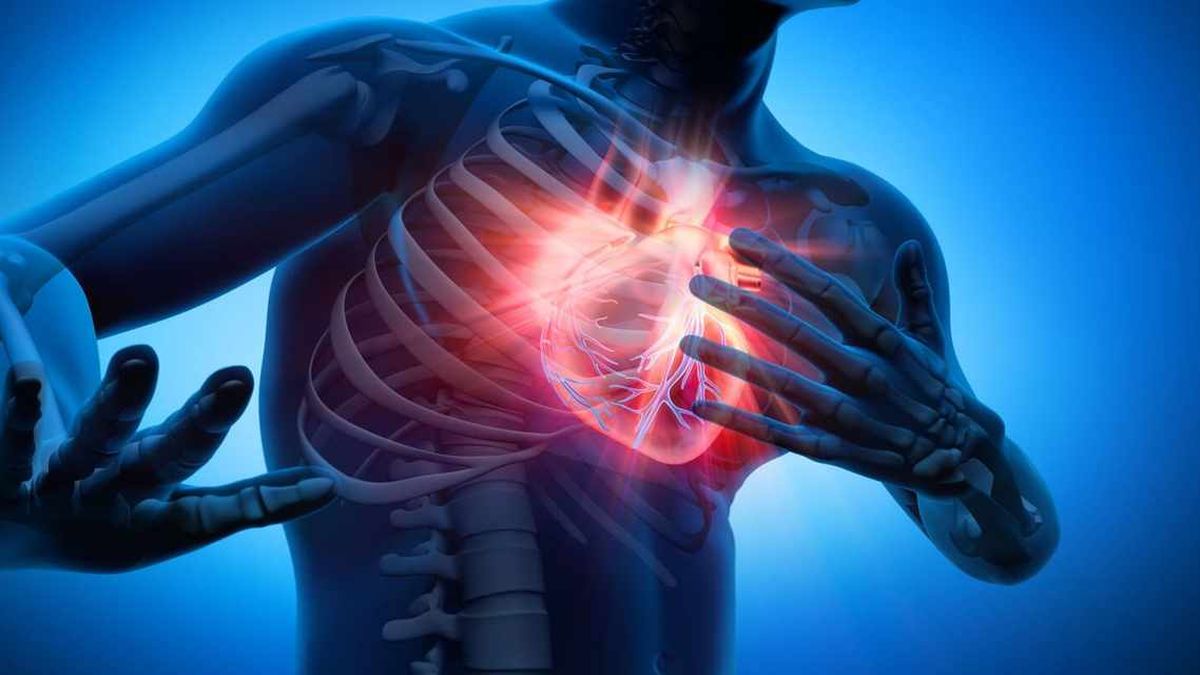 Cómo detectar el riesgo de un infarto antes de que sea demasiado tarde