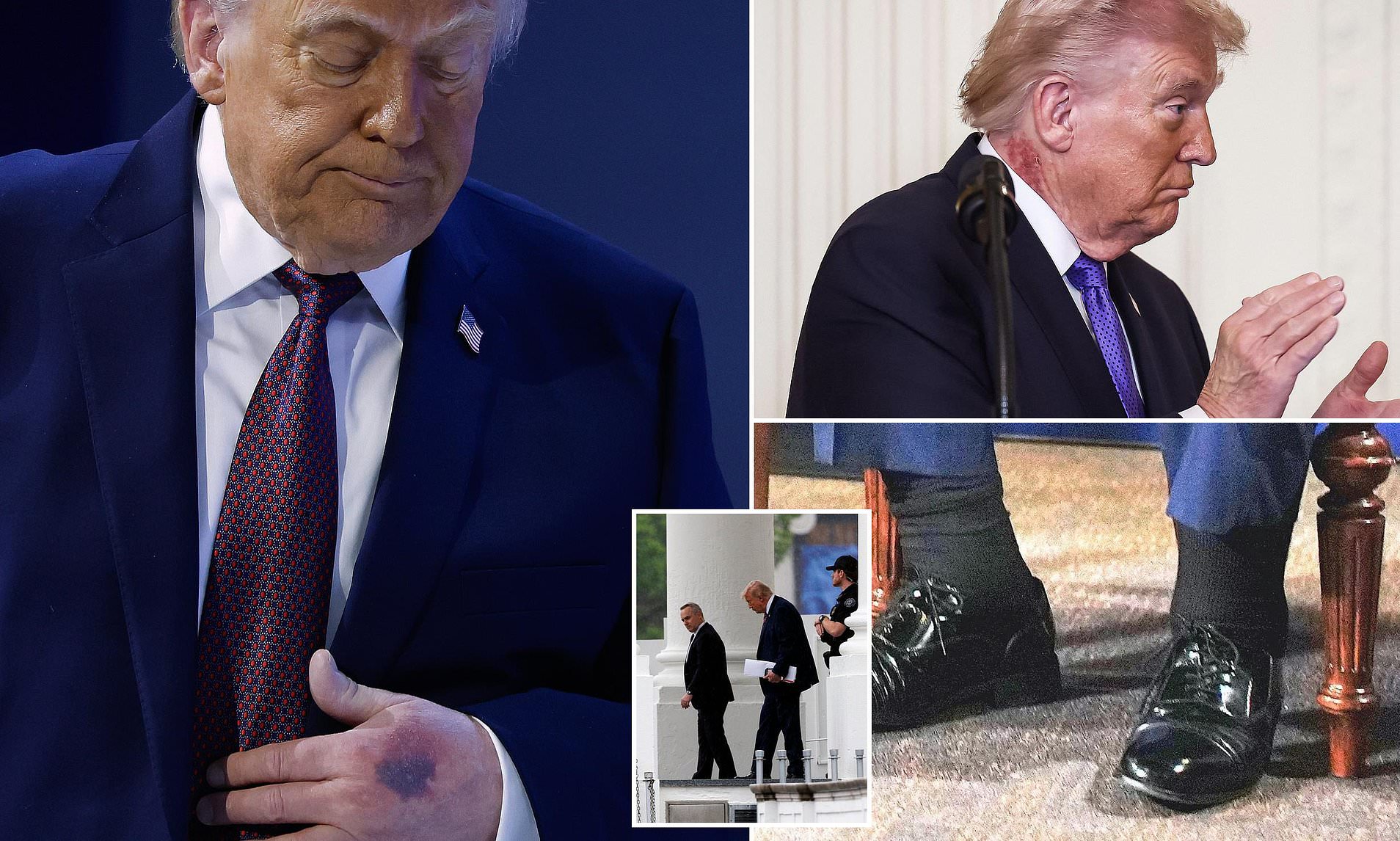 Trump's delayed physical results raise eyebrows amid worries about his ...