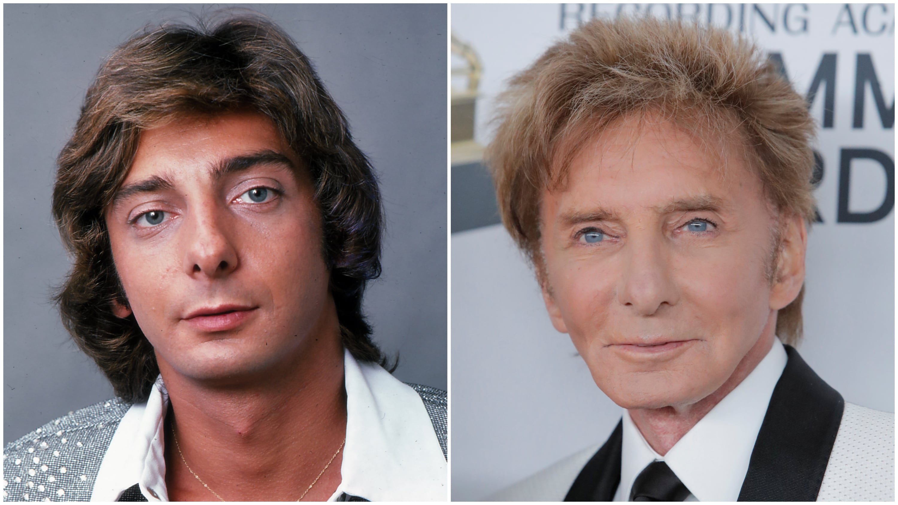 barry manilow plastic surgery Image 1
