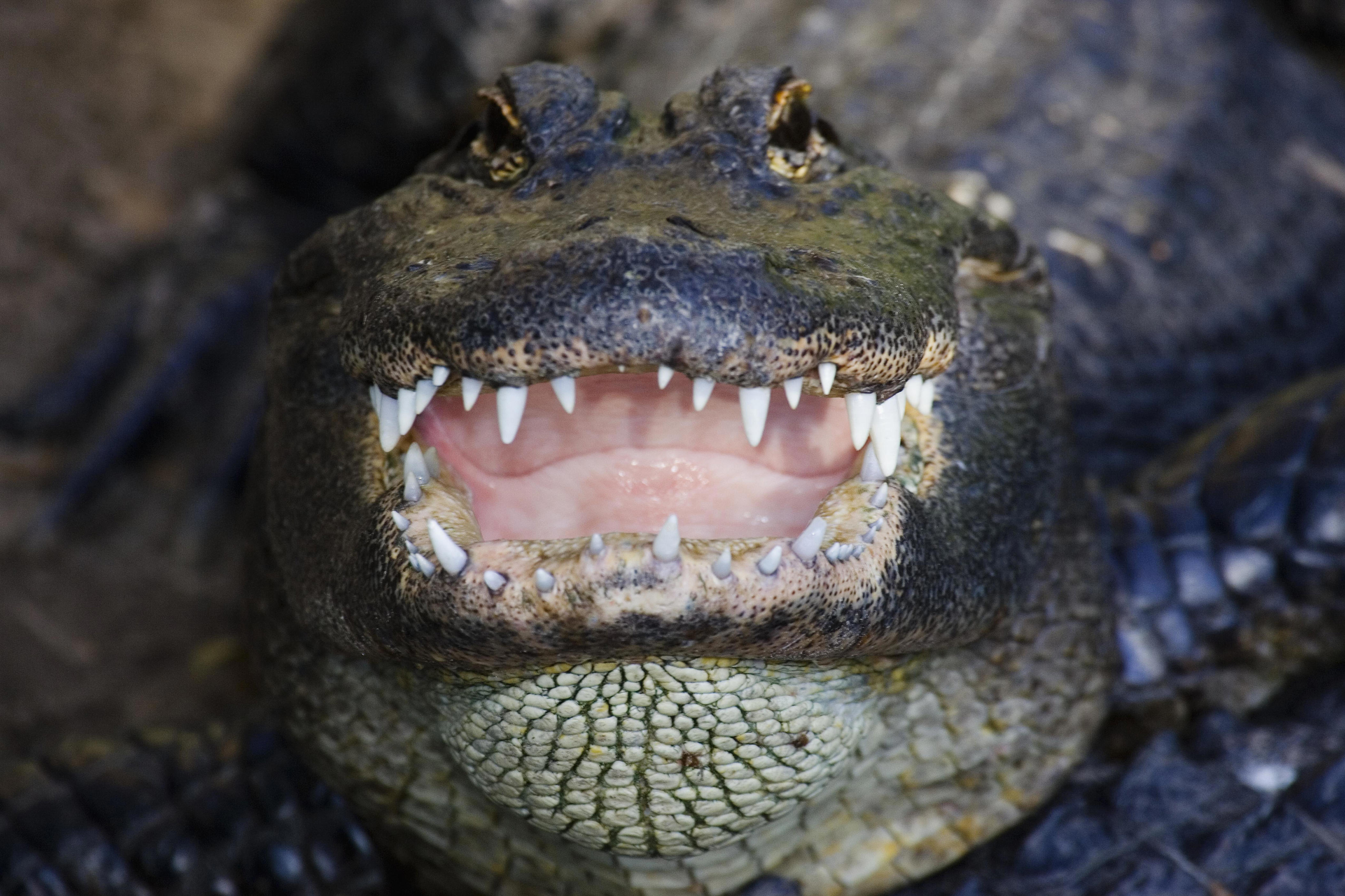 Woman suffers severe injuries in Florida alligator attack