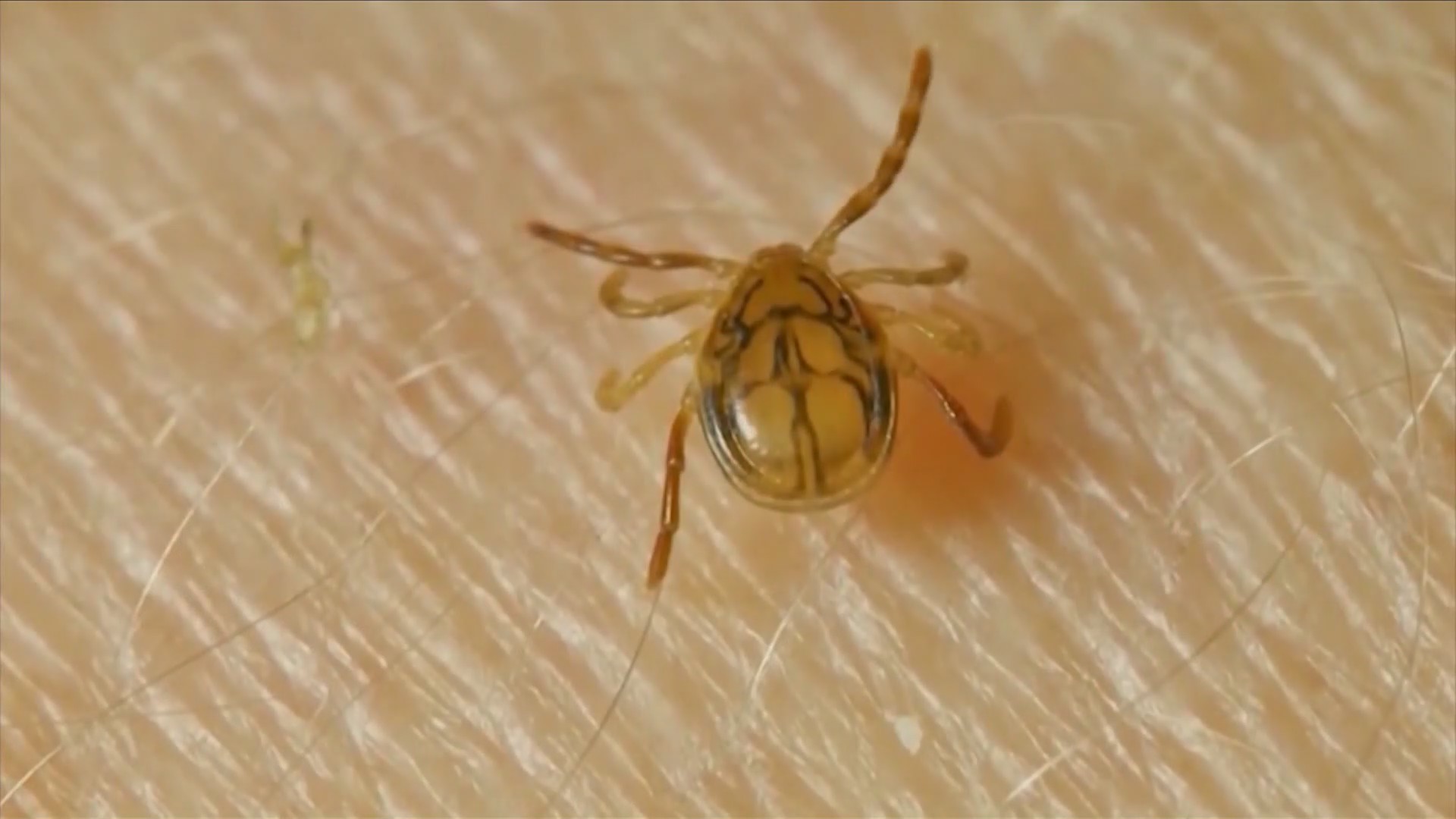 CDC reports record high tick illnesses