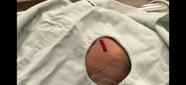 Saskatoon cab driver calls for change after getting shot in face with ...