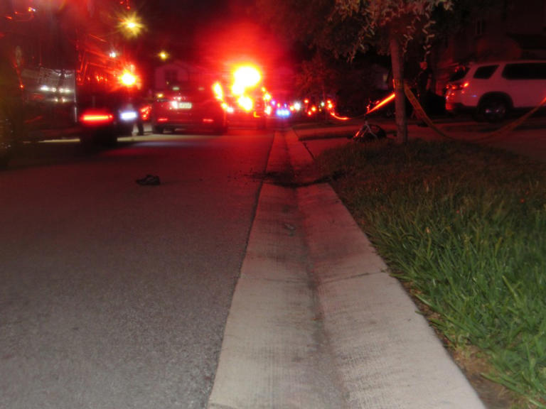 7-year-old hospitalized after being hit by car while riding scooter in ...