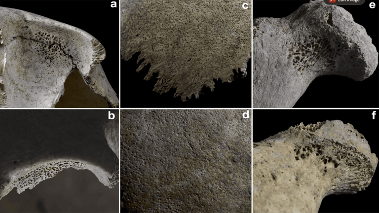 5,000-year-old famous mass grave reveals how ancient disease affected ...