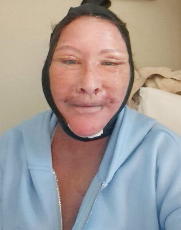 Man who's injected Melanotan II for years shares before and after photos