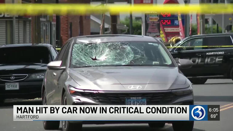 Man in his 20s critically injured after being struck by vehicle in Hartford
